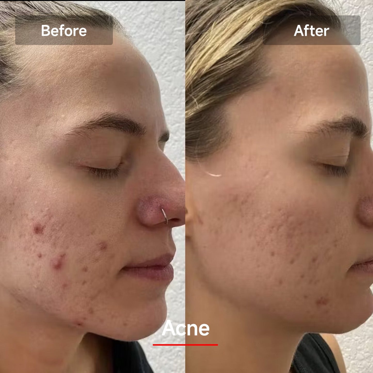 Megelin LED Red Light Therapy Face Mask